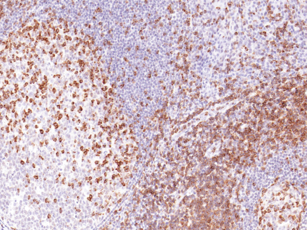 GeneAb™ CD2 Image