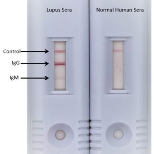 La(SSB) antibody serological assay (LSA)