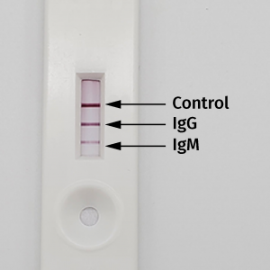 Postive Control for SARS-CoV-2 image