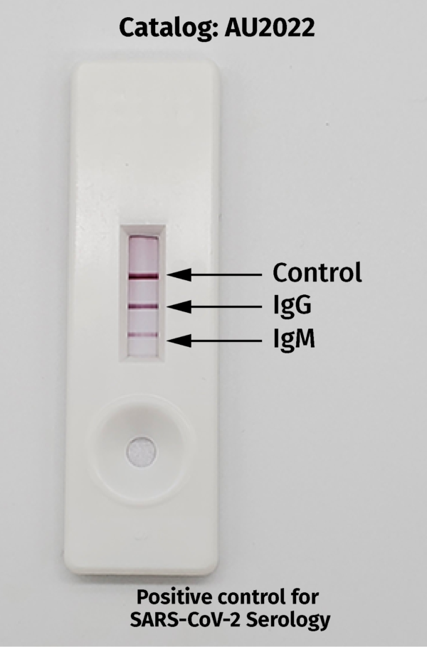 Postive Control for SARS-CoV-2 image