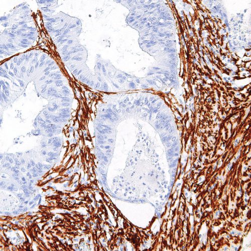 Actin-Smooth-Muscle-IHC506-Colon