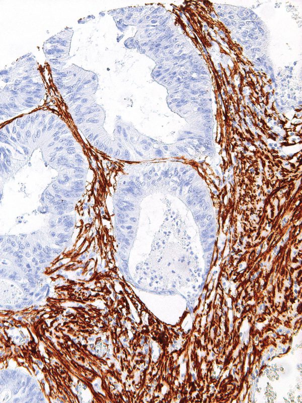 Actin-Smooth-Muscle-IHC506-Colon