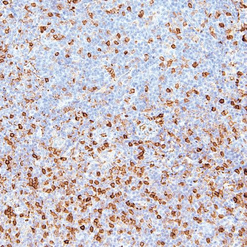 Annexin-A1-IHC512-Spleen