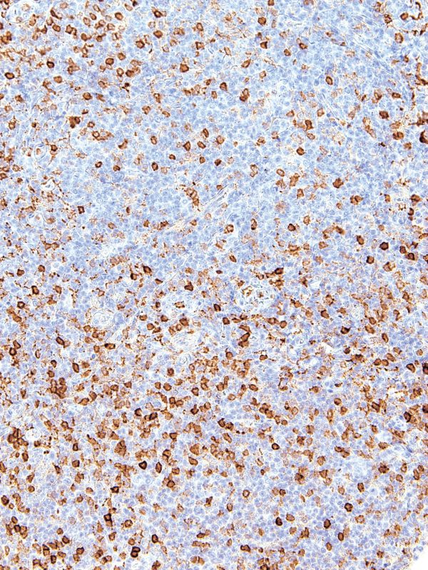 Annexin-A1-IHC512-Spleen