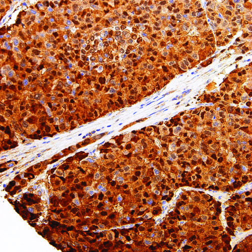 Arginase-1-IHC400-Liver