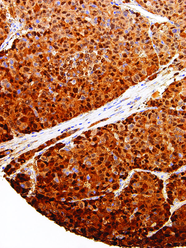 Arginase-1-IHC400-Liver