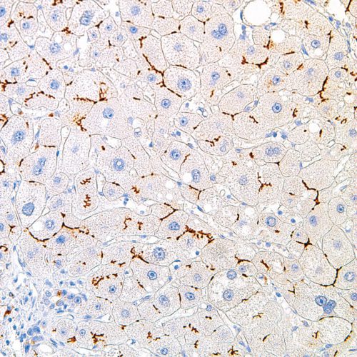 BSEP-IHC518-Liver