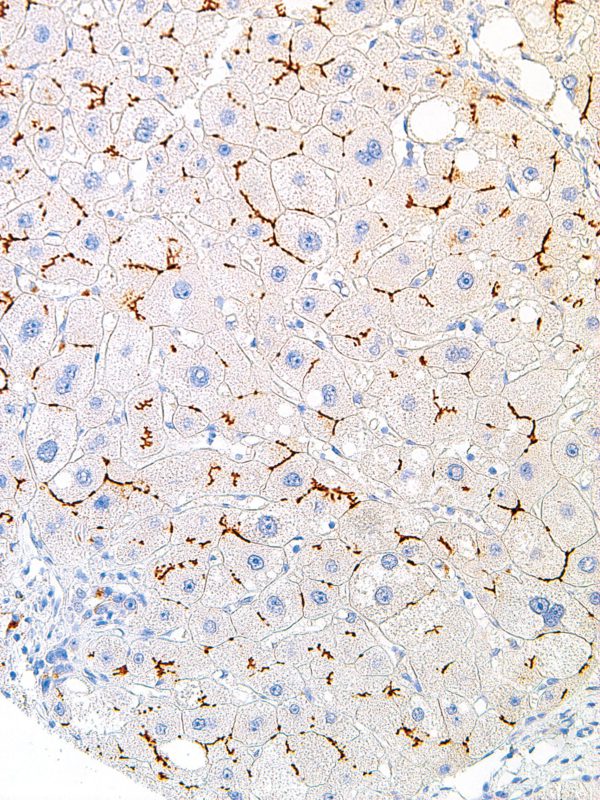 BSEP-IHC518-Liver