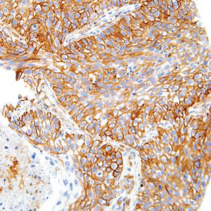 CD44-IHC044-Lung