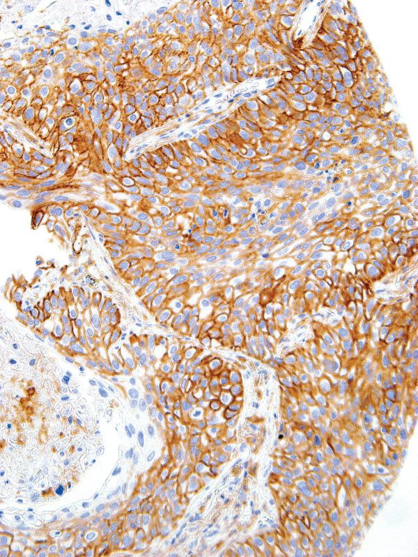 CD44-IHC044-Lung