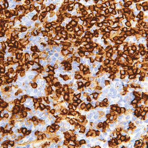 CD45R-IHC536-Tonsil