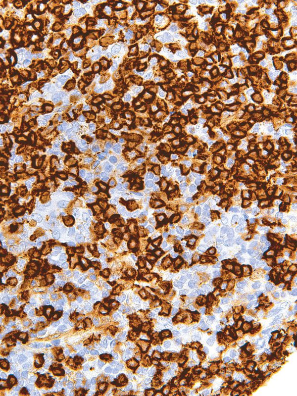 CD45R-IHC536-Tonsil