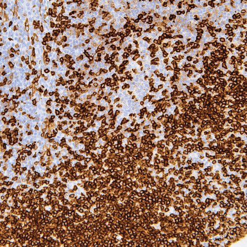 CD5-IHC538-Tonsil