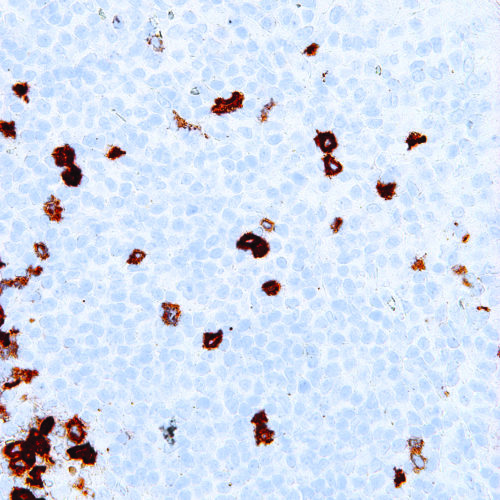 CD57-IHC539-Tonsil