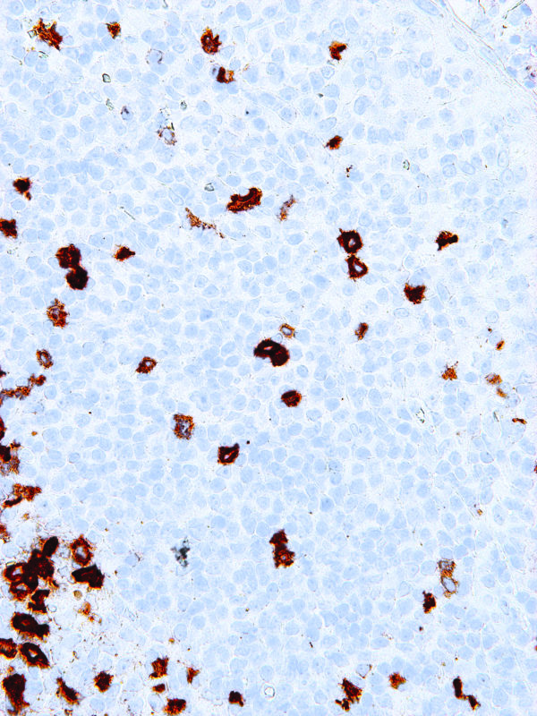 CD57-IHC539-Tonsil