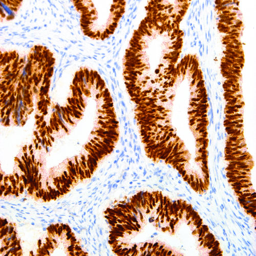 CDX-2-IHC402-Colon