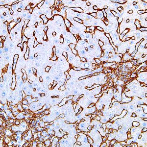 Collagen-Type-IV-IHC549-Liver