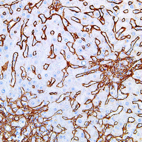 Collagen-Type-IV-IHC549-Liver