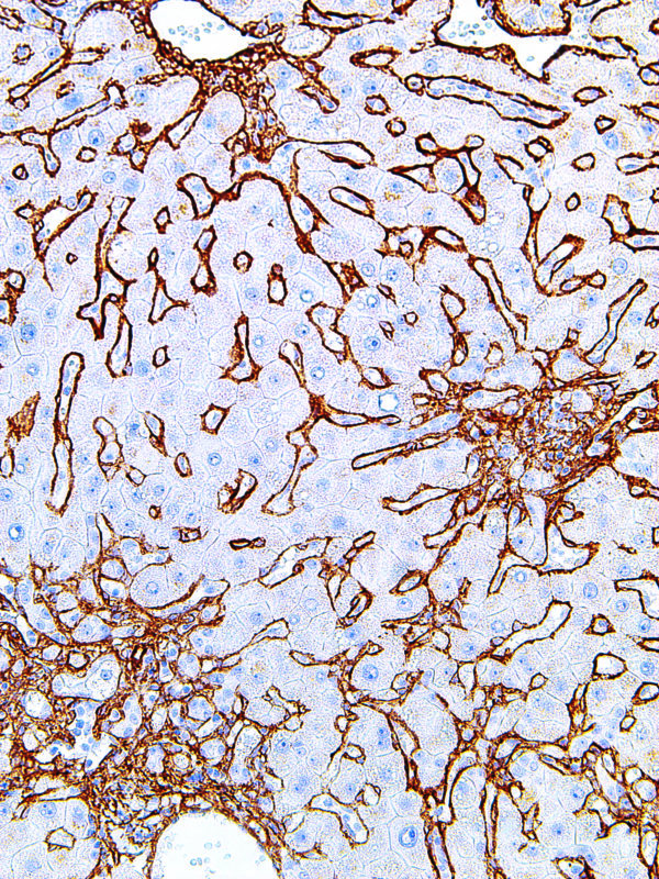 Collagen-Type-IV-IHC549-Liver