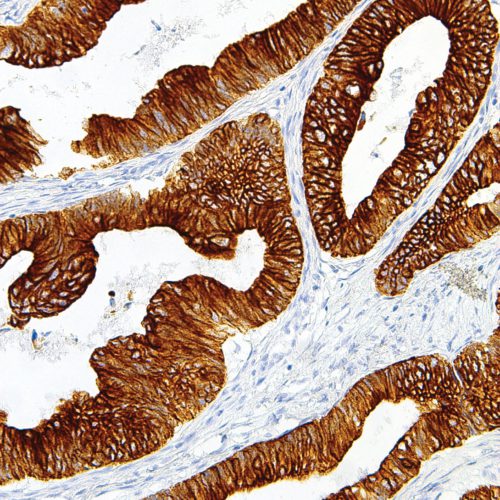 Cytokeratin-18-IHC018-Colon