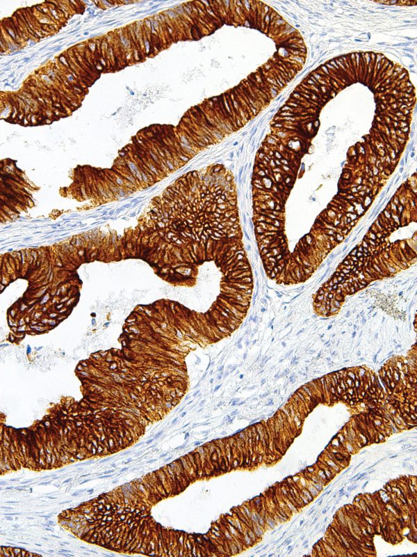 Cytokeratin-18-IHC018-Colon