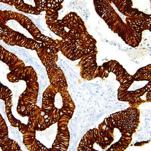 Cytokeratin-19-IHC019-Colon