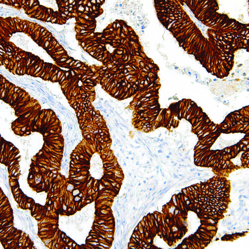 Cytokeratin-19-IHC019-Colon