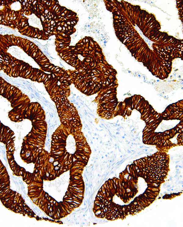 Cytokeratin-19-IHC019-Colon