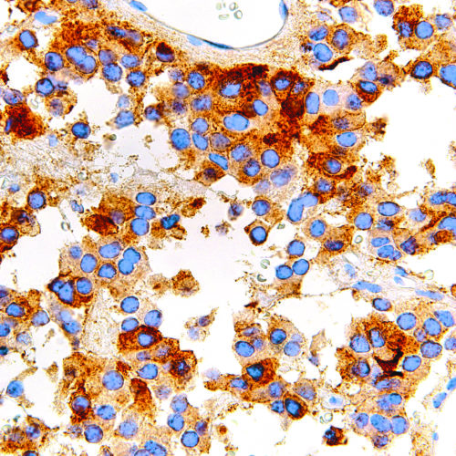 FSH-IHC580-Pituitary-Gland