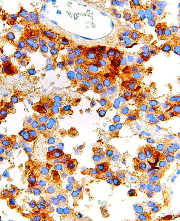 FSH-IHC580-Pituitary-Gland