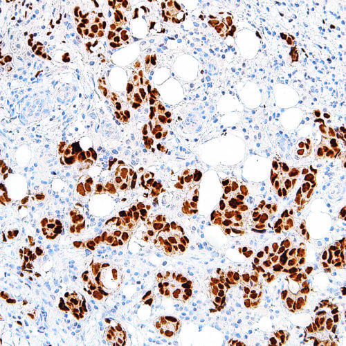 GATA3-IHC583-Breast