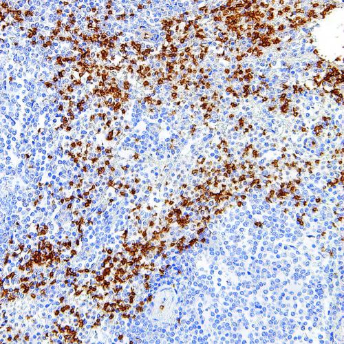 Glycophorin-A-IHC587-Spleen