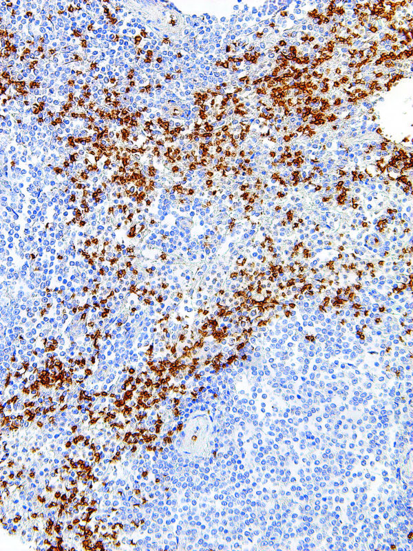 Glycophorin-A-IHC587-Spleen