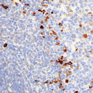 Kappa-IHC610-Tonsil