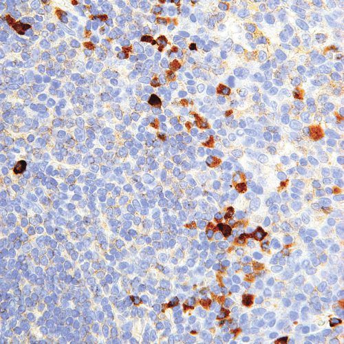 Kappa-IHC610-Tonsil