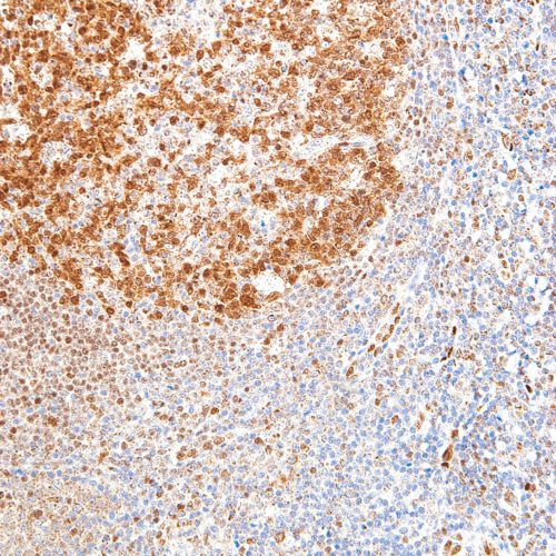 LMO2-IHC615-Tonsil