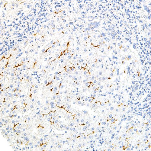 MDR3-IHC621-Liver