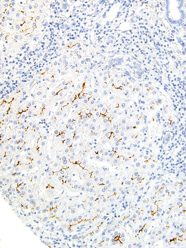 MDR3-IHC621-Liver