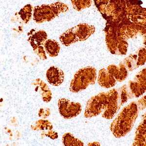 MUC5AC-IHC625-Stomach-