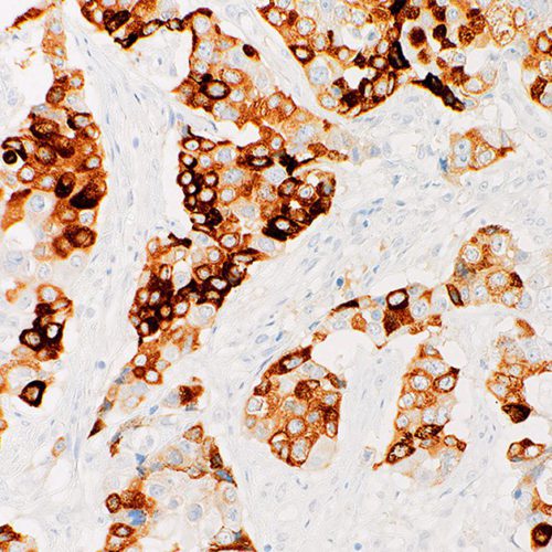 MUC6-IHC626-Pancreas