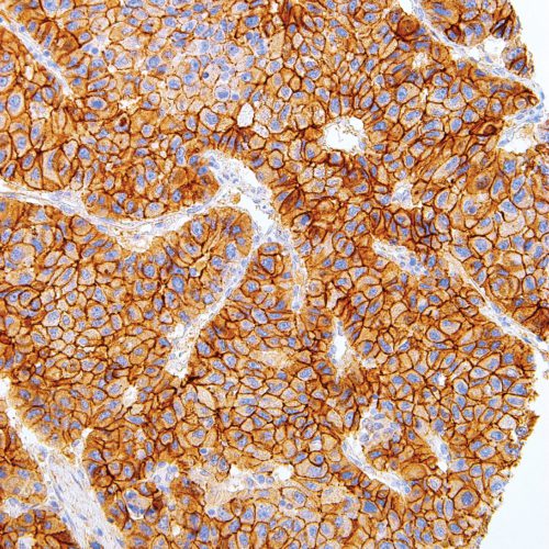 N-Cadherin-IHC636-Liver