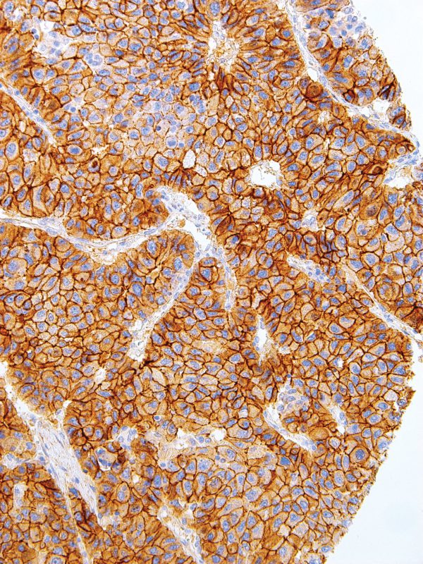 N-Cadherin-IHC636-Liver