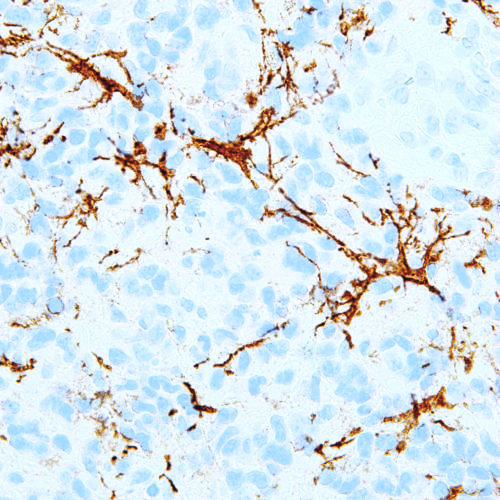 Nerve-Growth-Factor-Receptor-NGFR-IHC637-Brain