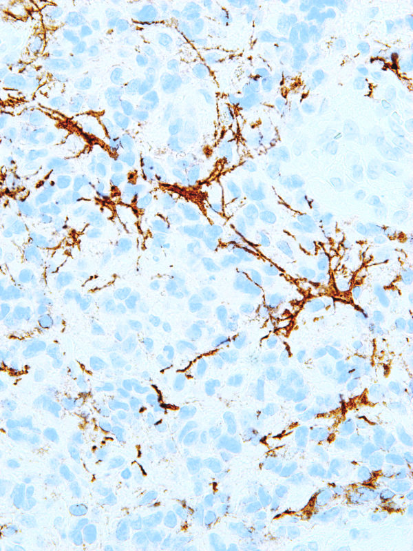 Nerve-Growth-Factor-Receptor-NGFR-IHC637-Brain