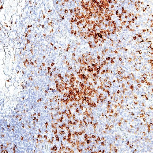 PD-1-IHC001-Tonsil