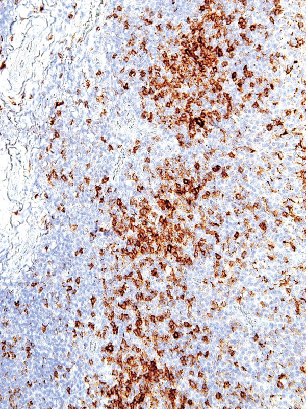 PD-1-IHC001-Tonsil