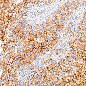 PD-L1-IHC411-Lung