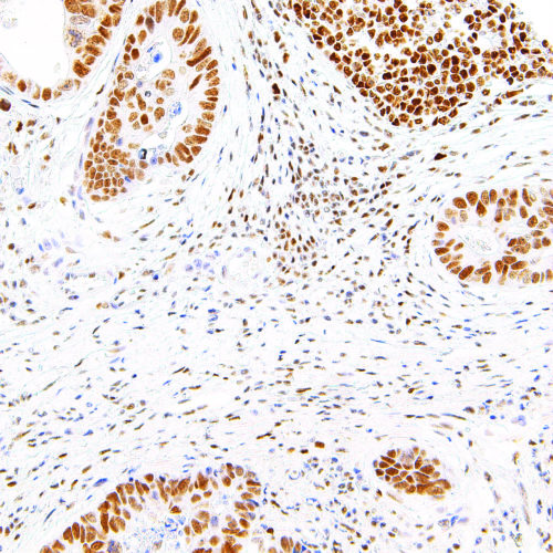 PMS2-IHC412-Intestine