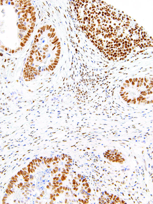 PMS2-IHC412-Intestine