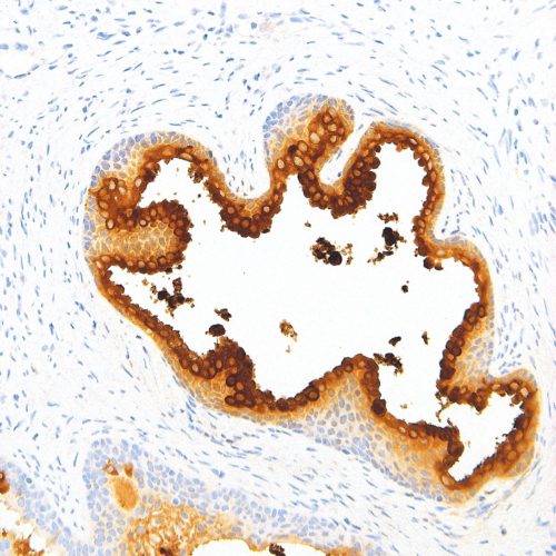 PSA-IHC654-Prostate